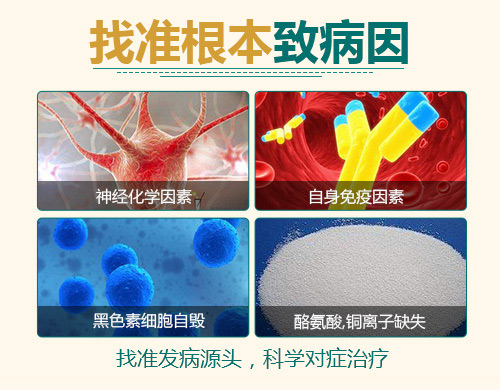 17-白癜风是怎么引起的-5.jpg